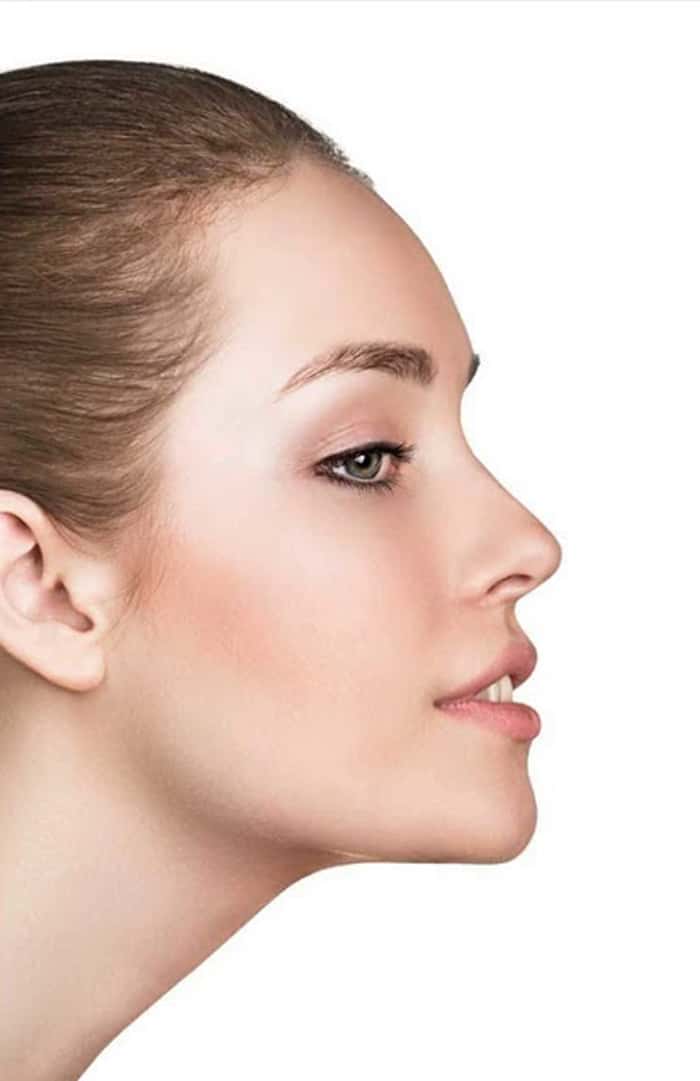 مراقبت‌های پس از عمل بینی نیمه فانتزی