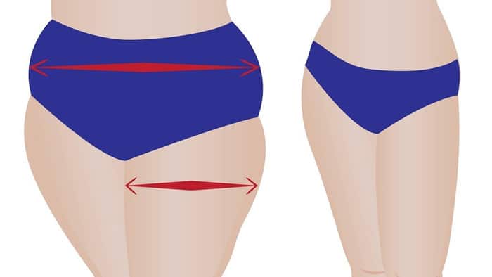 مزایای لیپوساکشن ران در مشهد