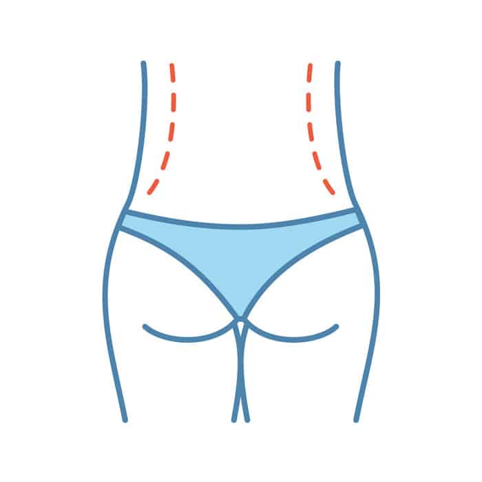 هزینه لیپوساکشن کمر در مشهد چقدر است؟