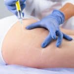 فیلر باسن در مشهد