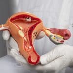 کدام روش تنگ کردن واژن بهتر است