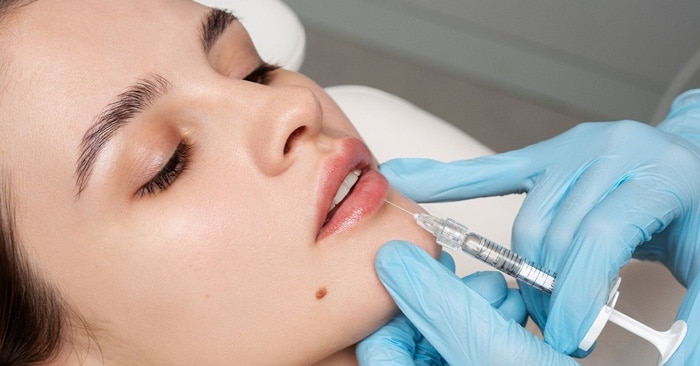 مراحل تزریق فیلر