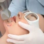 لیزر فوتونا چیست و چگونه عمل میکند؟