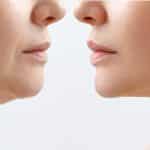 لیپوماتیک غبغب چیست