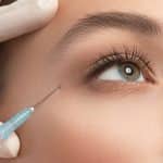 بایدها و نبایدهای بوتاکس بعد از بلفاروپلاستی
