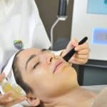 اسیدتراپی برای لک چیست